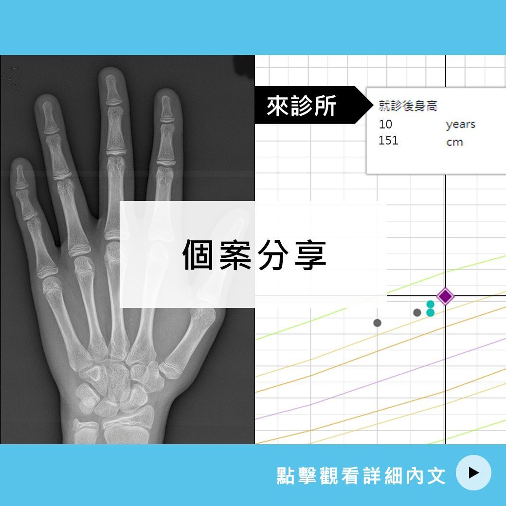 10歲林妹妹 長高案例分享