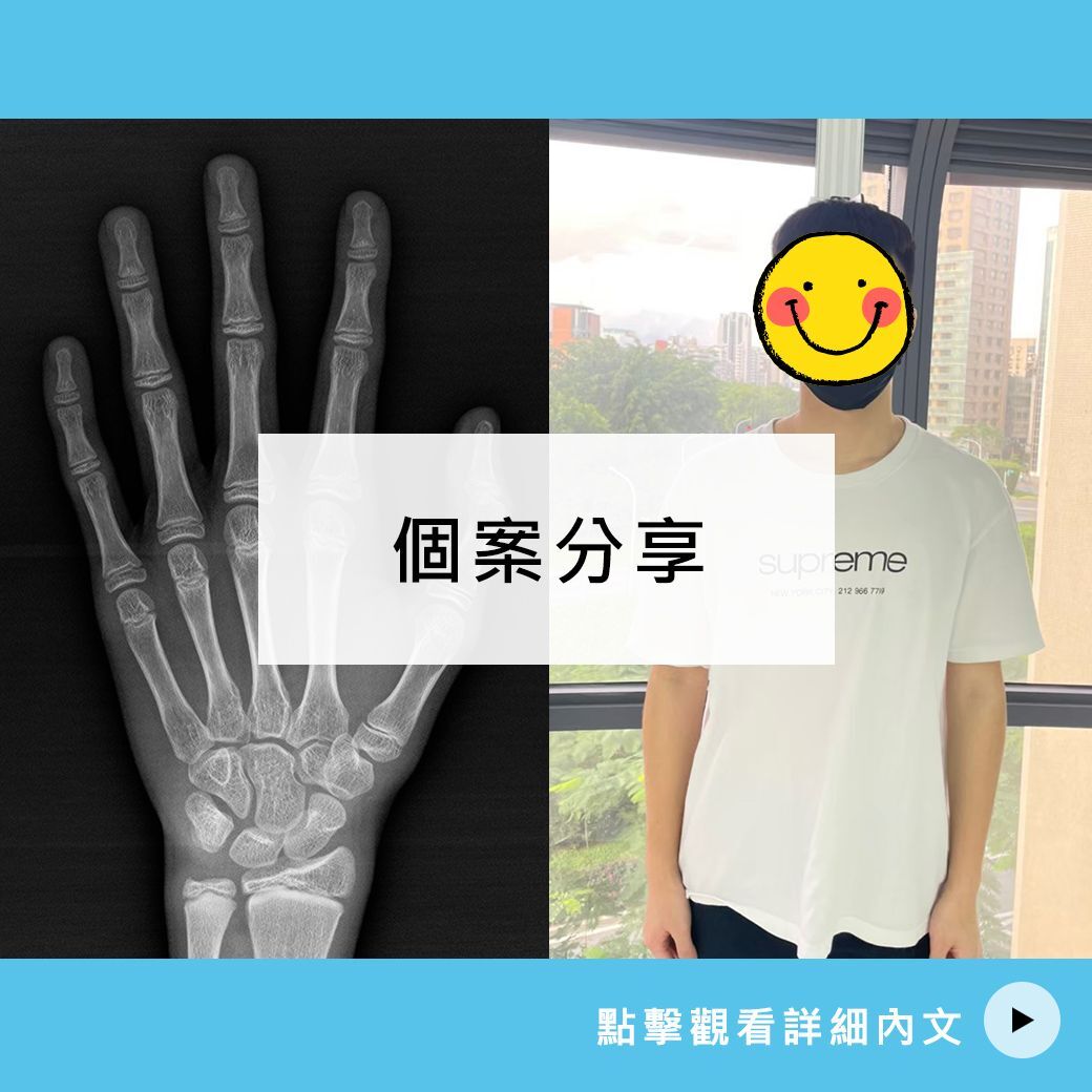 18歲8個月 王弟弟案例分享