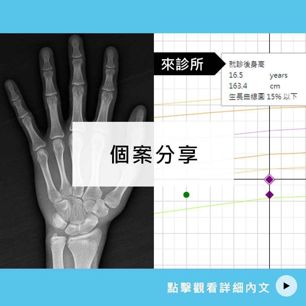 16歲 蔡哥哥長高案例分享