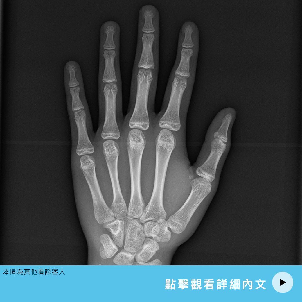 什麼是「骨齡」?