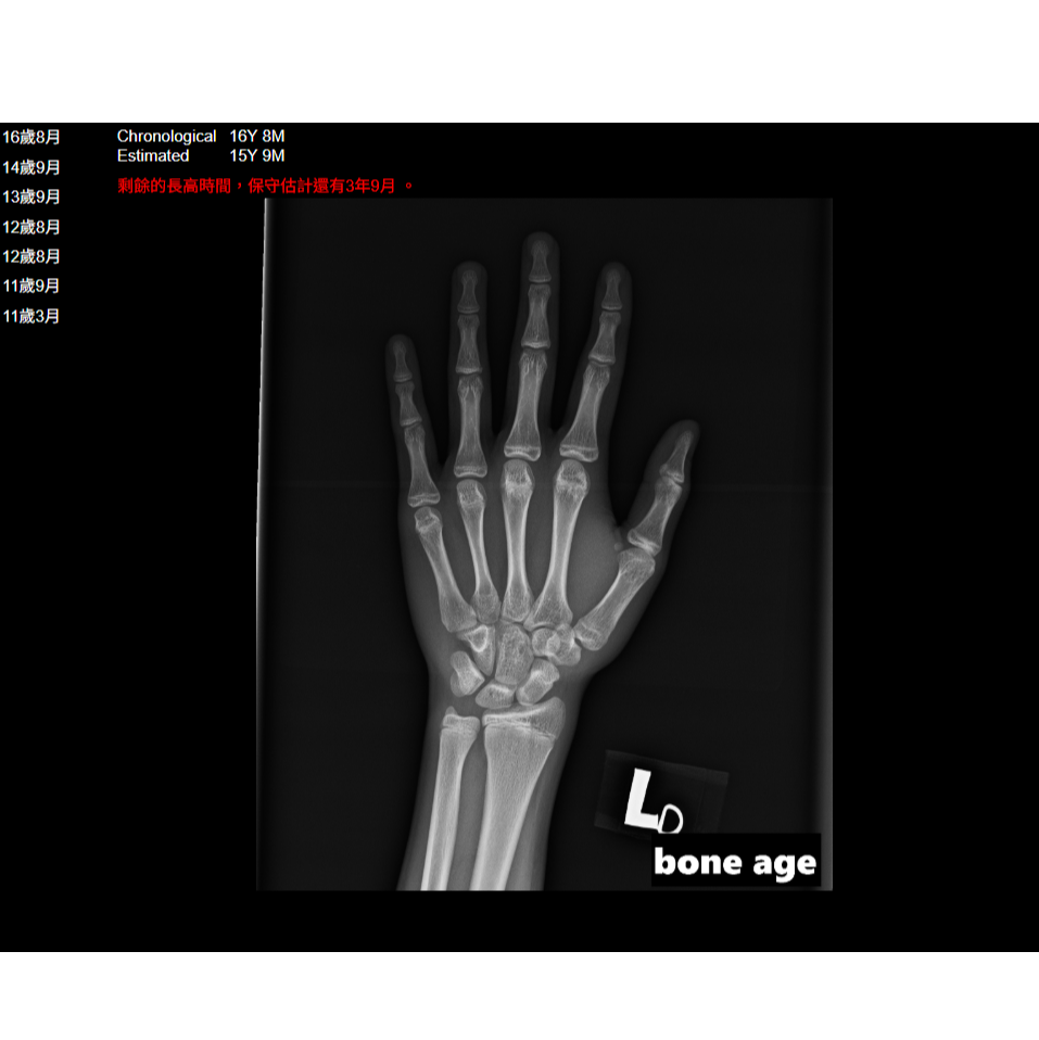 AIBoneage成長規劃評估師~免費評估及規劃建議