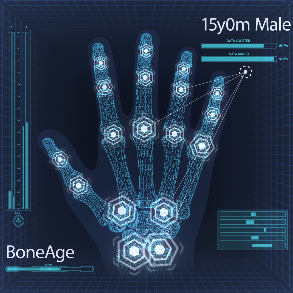 AIBoneAge高人一等兒童及青少年骨齡檢測親子衛教講座　報名表